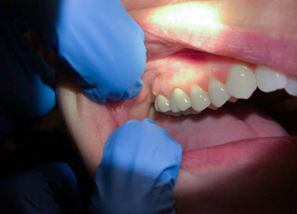 Best Emergency Cosmetic Dentistry (e.g., broken veneers) in Primera, TX